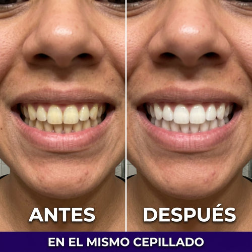 Antes y después en el mismo cepillado